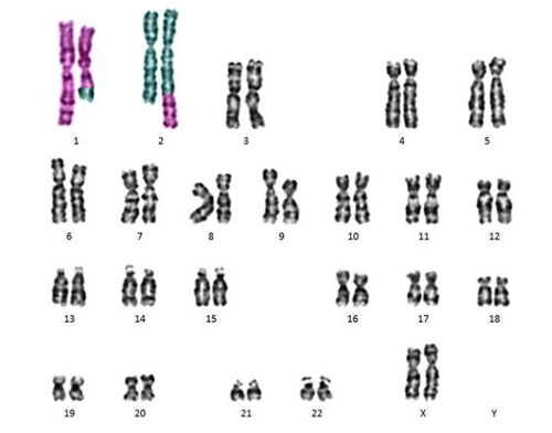 染色体筛查可以查出什么时候？染色体检查是抽血吗？