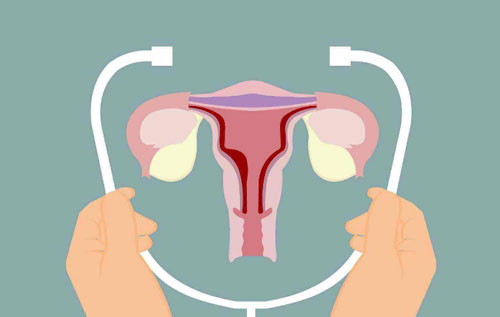 子宫纵隔能在成都做试管婴儿吗？这种情况做试管要什么条件？