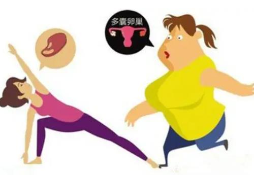 多囊会引起肥胖吗？多囊卵巢导致肥胖能治好？